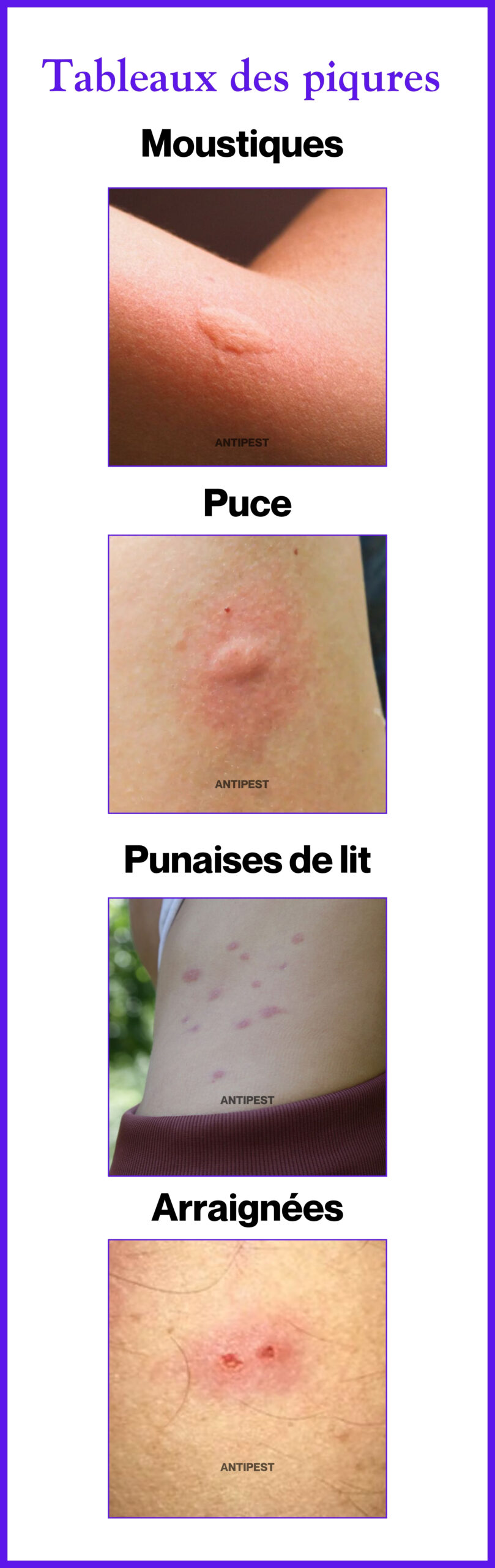 Piq re De Punaise De Lit Reconna tre Soulager Et Agir Efficacement 